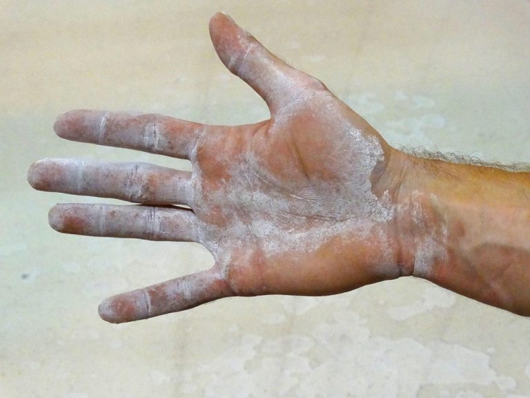 Climber's open hand dusted with chalk